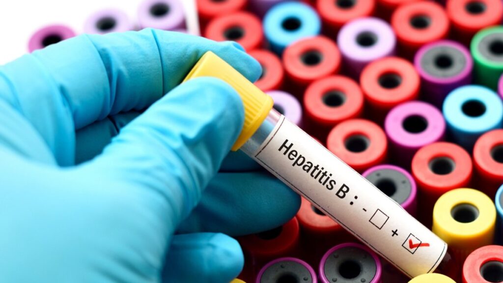 hepatitis-viral-causaria-mas-muertes-que-malaria,-tuberculosis-y-sida-combinados-para-2040