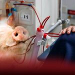 Hombre pasa nueve meses sin diálisis gracias a un riñón de cerdo hasta que puso hacer trasplante